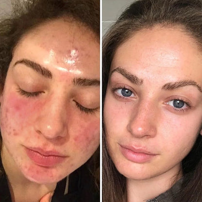 Medicube Collagen Night Wrapping Peel Off Mask